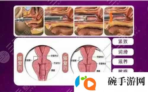 欧洲之星私密紧致