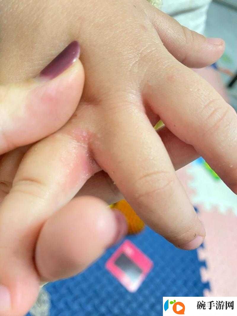 手指划入缝隙挖水的技巧